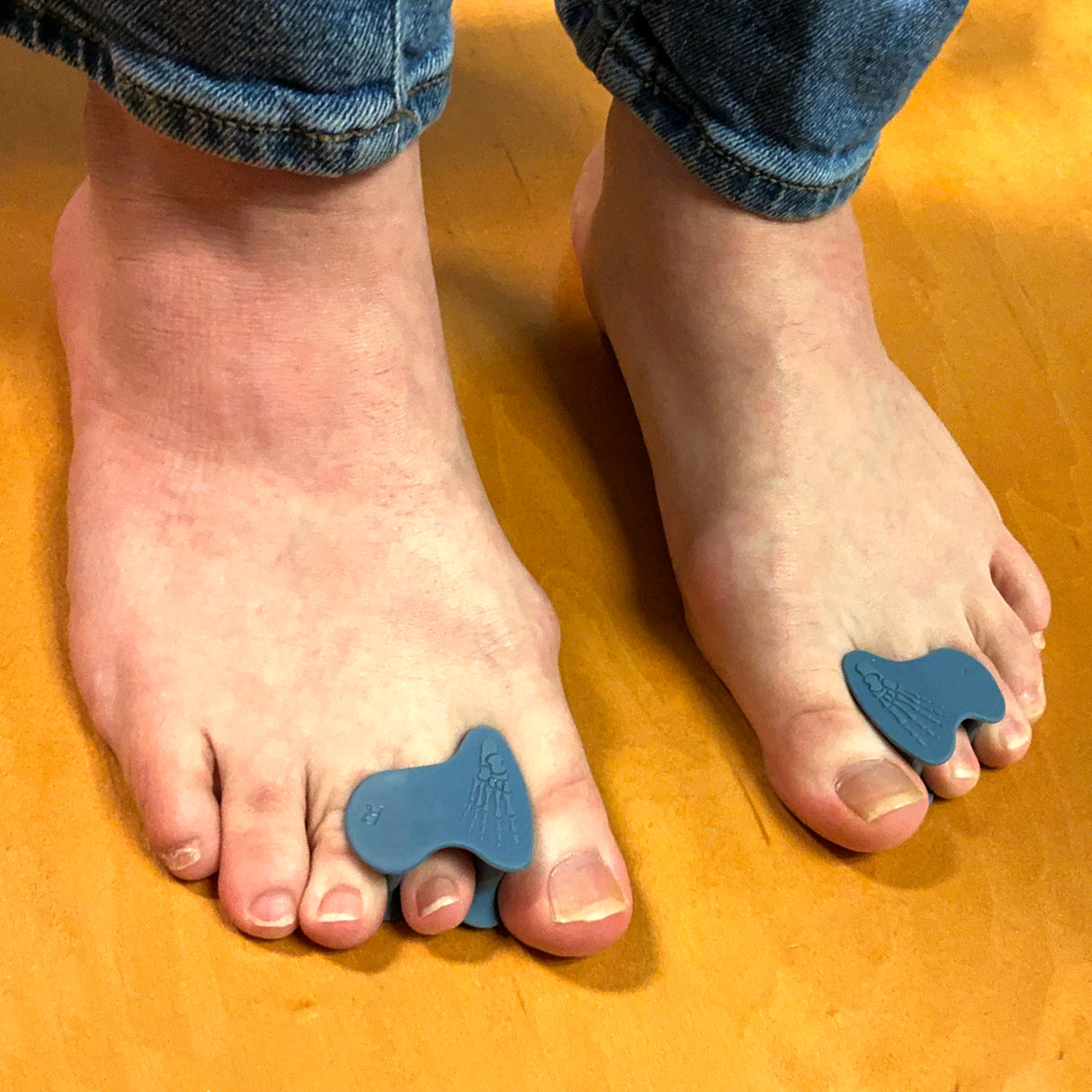 Blue silicone toe spacers worn on big and second toes on bare feet with jeans cuffs visible.