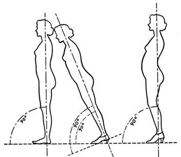 Why Shoes Make “Normal” Gait Impossible - by Dr. William A. Rossi, D.P.M.