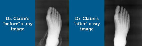 XRay_Claire