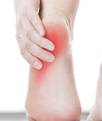 Plantar Fasciosis